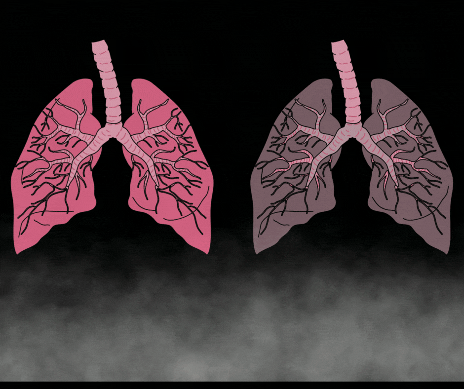 Animation of lungs decaying due to smoke usage. 